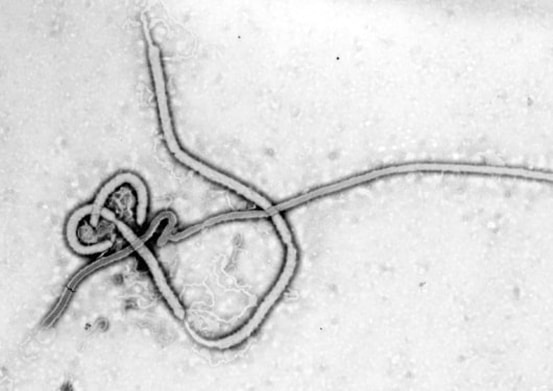 Microfotografía electrónica del virus Ébola.